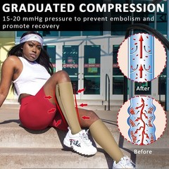 Medical Compression Socks with Zipper, Knee High 15-20 mmHg Compression Socks…