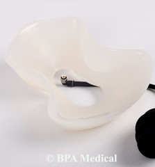 Small Vacuum Bell for Woman for Pectus Excavatum ( 190 mm – 7.5″ )