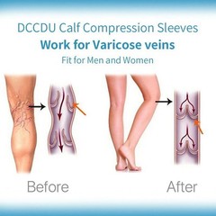 Thigh High Medical Compression Socks 20-30 mmHg DVT Stockings Varicose Women Men