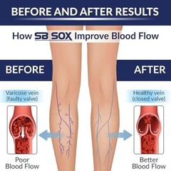 SB SOX Knee High Compression Socks (20-30mmHg) Black/Pink – XL – NEW