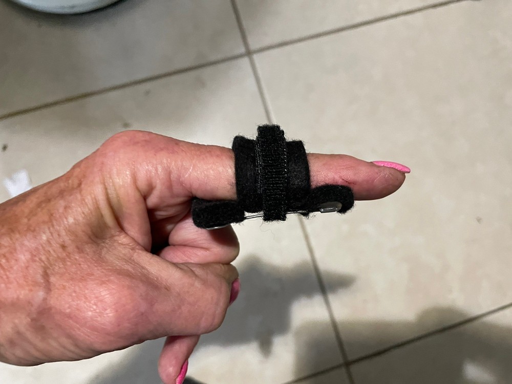 safety pin splint