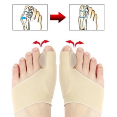 2 Pcs Toe Separator Bunion Corrector Hallux Bone Straightener Pedicure Tools
