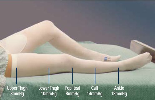 T.E.D. Knee-Length Anti-Embolism Stockings Size 2X-Large Regular EA of 1