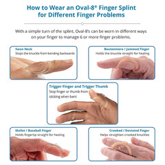 Oval-8 Finger Splint, Size 5, Pack of 1, Beige | Support and Protection for Arth