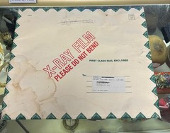 X-rays lot of 10 shoulder /ribs / Legs