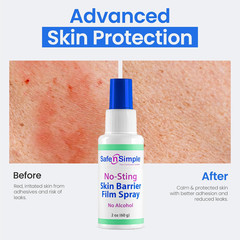Skin Barrier Spray No-Sting – 2Oz Bottle – Alcohol-Free Skin Prep Spray, Odor-Fr