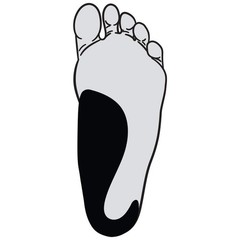 Profoot Good Posture Orthotic Alignment Insole, 1 Count (Pack of 1), Black
