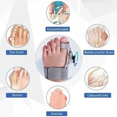 Bunion Fix Toe Valgus Corrector Adjustable Orthosis Women Men Splints