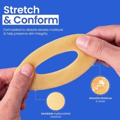 High-Tact & Stretchable 2″ Adhesive Stoma Seals – 10 Count for Comfort & Fit