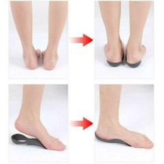 1 Pair Flat Foot Orthopedic Insoles New O-leg to Correct Collapse Support Flat