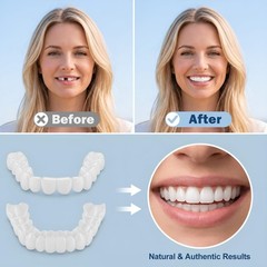 2 Pairs Adjustable Comfort Smiles for Self-Confidence – Unisex White Dental Alig