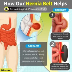 Adjustable Umbilical Hernia Belt for Men & Women – Abdominal Support Truss with