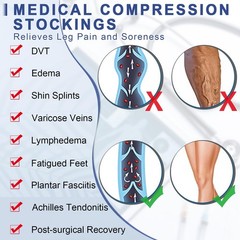 Beister 1 Pair Medical Open Toe Thigh High Compression Stockings with Silicone B