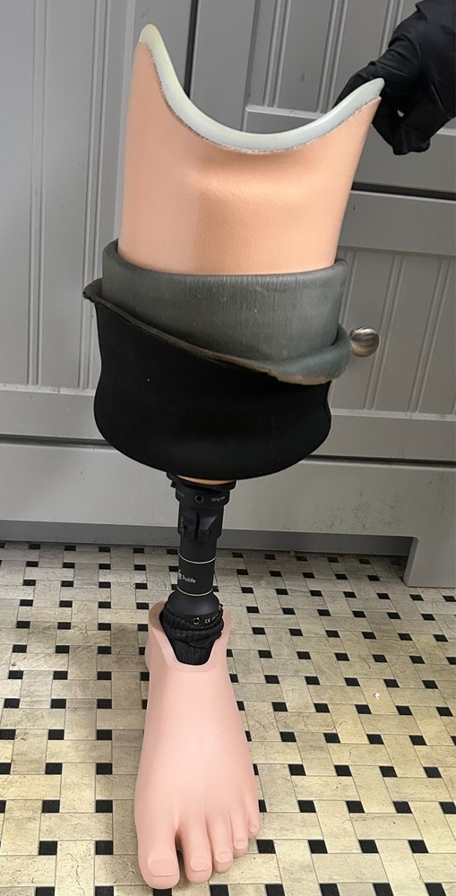Trulife below knee Prosthetic Leg