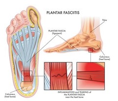 2x Plantar Fasciitis Relief Heel Cups for Foot Pain Relief Elastic Gel Pads USA