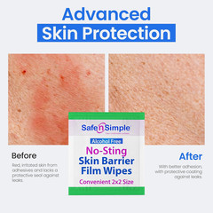 Safe n‘ Simple Skin Barrier Wipes No-Sting – 2″ x 2″ – 100 Count – Alcohol-Free