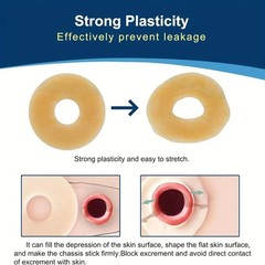 10 Pcs Ostomy Barrier Rings, 2mm Thickness Moldable Colostomy Rings, Medical Gra