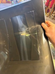 X-rays lot of 10 shoulder /ribs / Legs