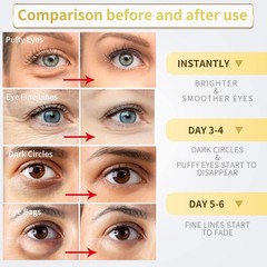 Parches de oro de 24 quilates para ojeras (paquete de 60) con colágeno y ácido