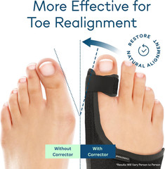Caretras 2-Pack Bunion Corrector for Women & Men, Orthopedic Bunion Splint for H