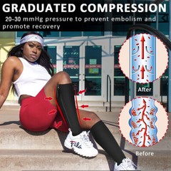 Compression Socks 1/2/3 Pk Stockings 20-30mmHg Knee High Support Open Toe Zipper