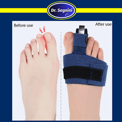 1 Pcs Toe Corrector Adjustable Splint Straightener Brace Support