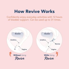 Revive Bladder Support Pessary for Women | Reusable Vaginal 1 Pack, White