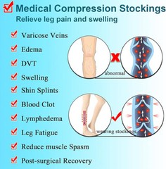 20-30 mmHg Thigh High Compression Stockings for Men and Women,Open Toe,Medium
