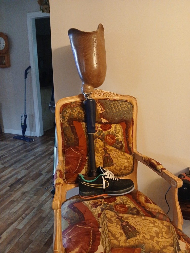 prosthetic leg above knee