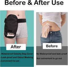 Waterproof Ostomy Bag Covers Adjustable Universal Stoma Pouch Cover for ileos…