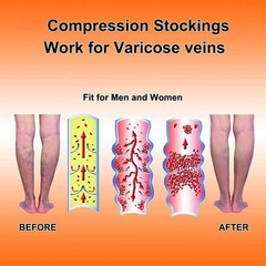 2x Unbranded Calf Compression Sleeves Leg Support Socks Shin Splint Varicose Vei