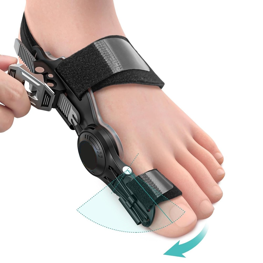 Women & Men Upgraded Hallux Valgus Bunion Corrector Orthopedic Big Toe Separator