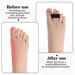 Buddy Tape Finger Straps, 8 Pcs Hook and Loop Finger Splint Buddy Tape, Finge…