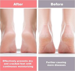 2 Pcs Silicone Foot Socks For Women Moisturizing Socks Foot Care Protector US