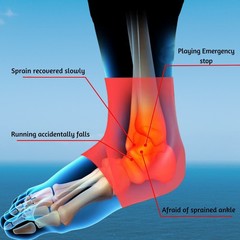 1 PAIR BAMBOO COMPRESSION ANKLE SUPPORT BRACE GUARD ARTHRITIS PAIN SPORTS