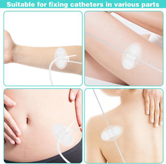 10Pcs Foley Catheter Stabilization Device, Urinary Catheter Leg Bag Holder, A…