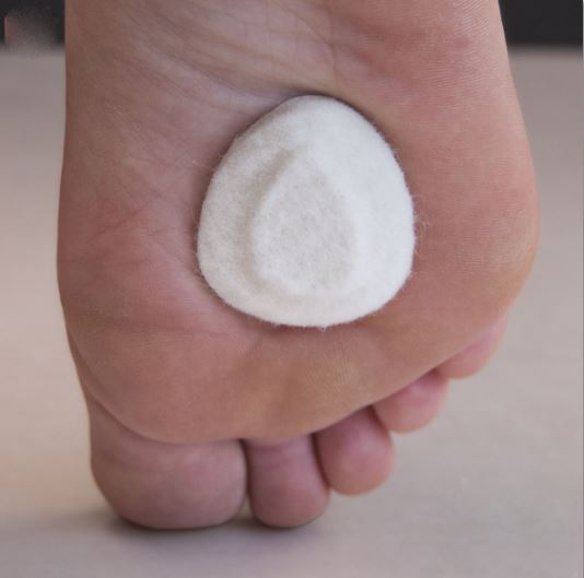 Dr. Jill’s Small Skived Felt Metatarsal Pads 1/4″
