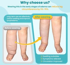 Sylong Adjustable Calf Compression Wrap Lymphedema Circulation XL Black