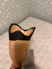Ottobock Bulldog/Trulife/Soleus Prosthetic Leg Below Knee Left, SEE DESCRIPTION