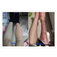 Skin Artificial Silicone Prosthesis Foot Sleeve Leg Cover Scars Highly Simulated