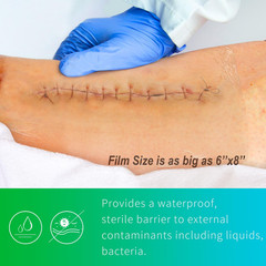 Transparent Film Dressing, Waterproof Wound Cover, 6×8 Inches, 20 Packs, Post