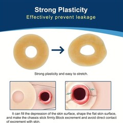 10 PCS Ostomy Barrier Rings, 2mm 10 Count (Pack of 1), 2mm,10pcs/Box