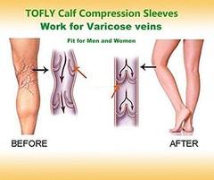 ® Calf Compression Sleeve for Men & Women, 1 Pair, Footless Compression Socks…