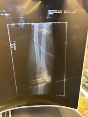 X-rays lot of 10 shoulder /ribs / Legs