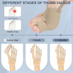 2PCS Bunion Corrector for Women & Men Big Toe Relief Toe Straightener Support S