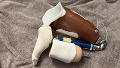 Vintage Ottobock Titan Left – Above the knee with Original Stub