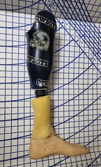Complete Prosthetic Left Leg Knee WillowWood Limblogic Trulife Adult Dallas Cowb