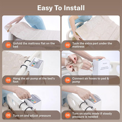Alcedo Alternating Air Pressure Mattress Pad with Static Mode for Bed Sore and U