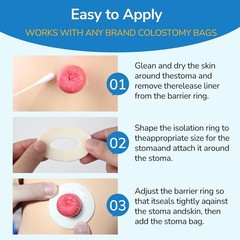 Protective Ostomy Bag Seal Rings 2–4mm Moldable Hydrocolloid Barrier 10 or 30PCS