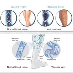 Unisex Miracle Flight Travel Compression Socks Anti Swelling Fatigue DVT Support